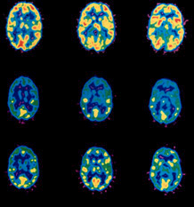 Brain-scan-21.jpg (218×233)