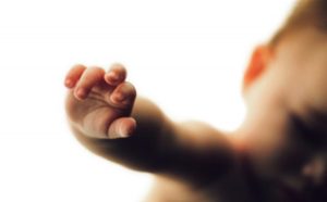 antidepressant-birth-defects-hand