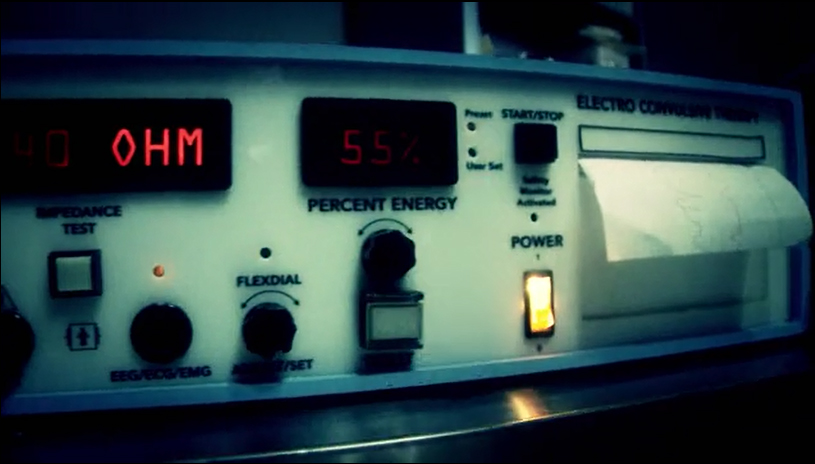 New Study Reveals Alarming Cardiac Risks Associated with Electroshock Treatment