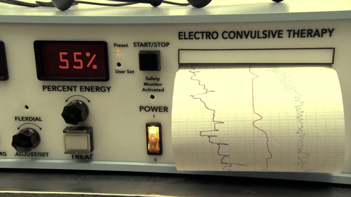 Electroshock Therapy Machine (ECT) - A-1 Medical Integration